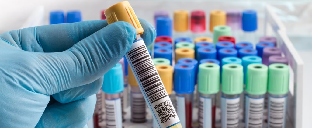 Schaalvergroting strategische oplossing